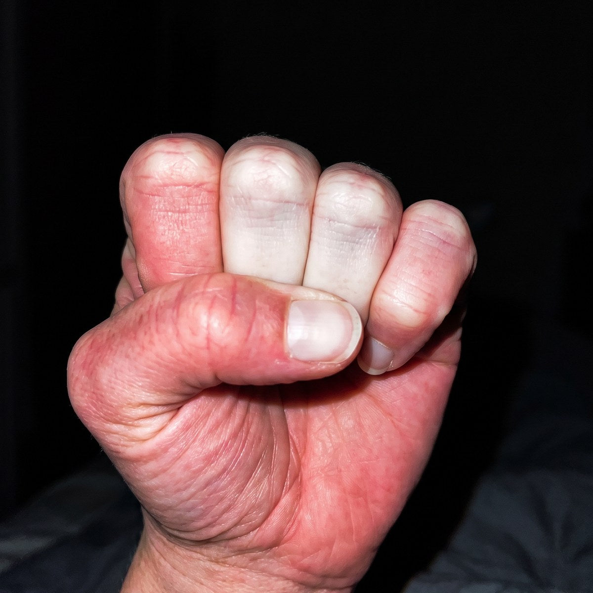 A woman's fist clenched hard, the fingers gone white
